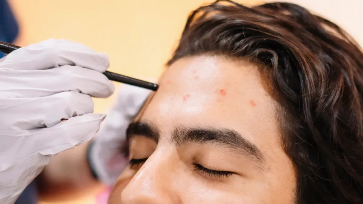 &iquest;Para qu&eacute; se utiliza principalmente una pluma de trasplante de cabello?